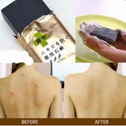 Xà Phòng Trị Mụn Lưng Pelican For Back Medicated Soap